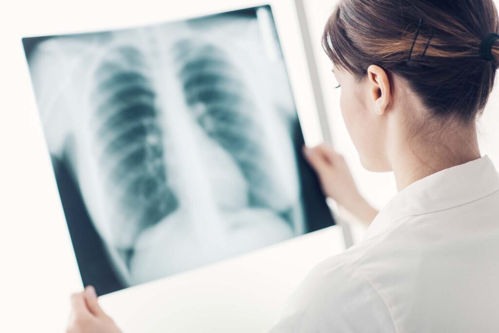 Doctor examining a patient's x-ray of lungs